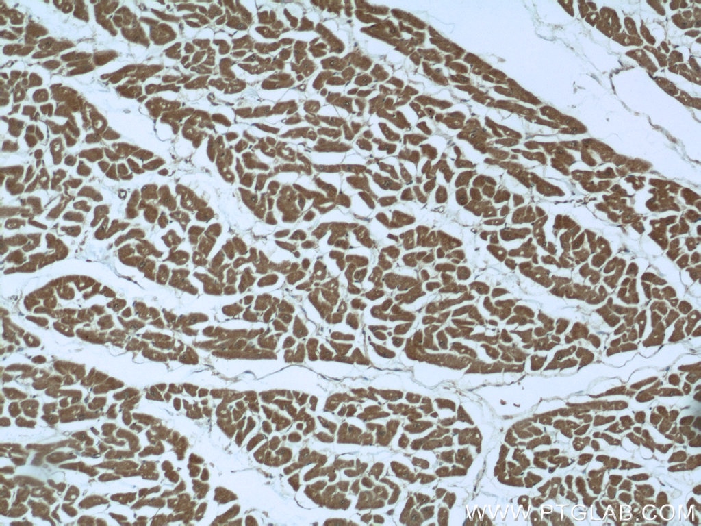 IHC staining of human heart using 51069-2-AP