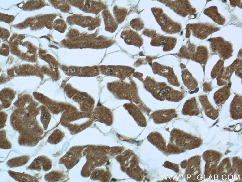 Immunohistochemistry (IHC) staining of human heart tissue using SMAD4 Polyclonal antibody (51069-2-AP)