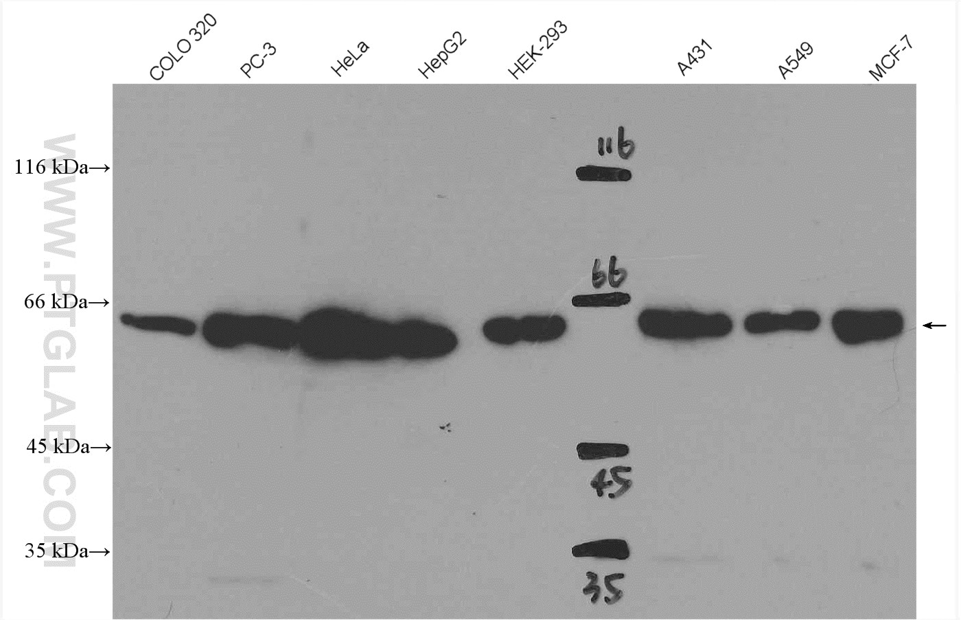 Western Blot (WB) analysis of various lysates using SMAD4 Polyclonal antibody (51069-2-AP)