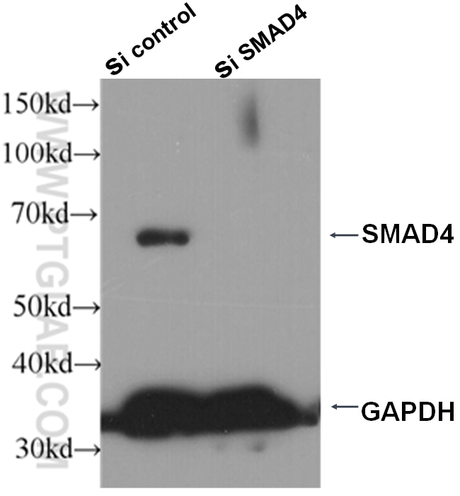 Western Blot (WB) analysis of HepG2 cells using SMAD4 Polyclonal antibody (51069-2-AP)