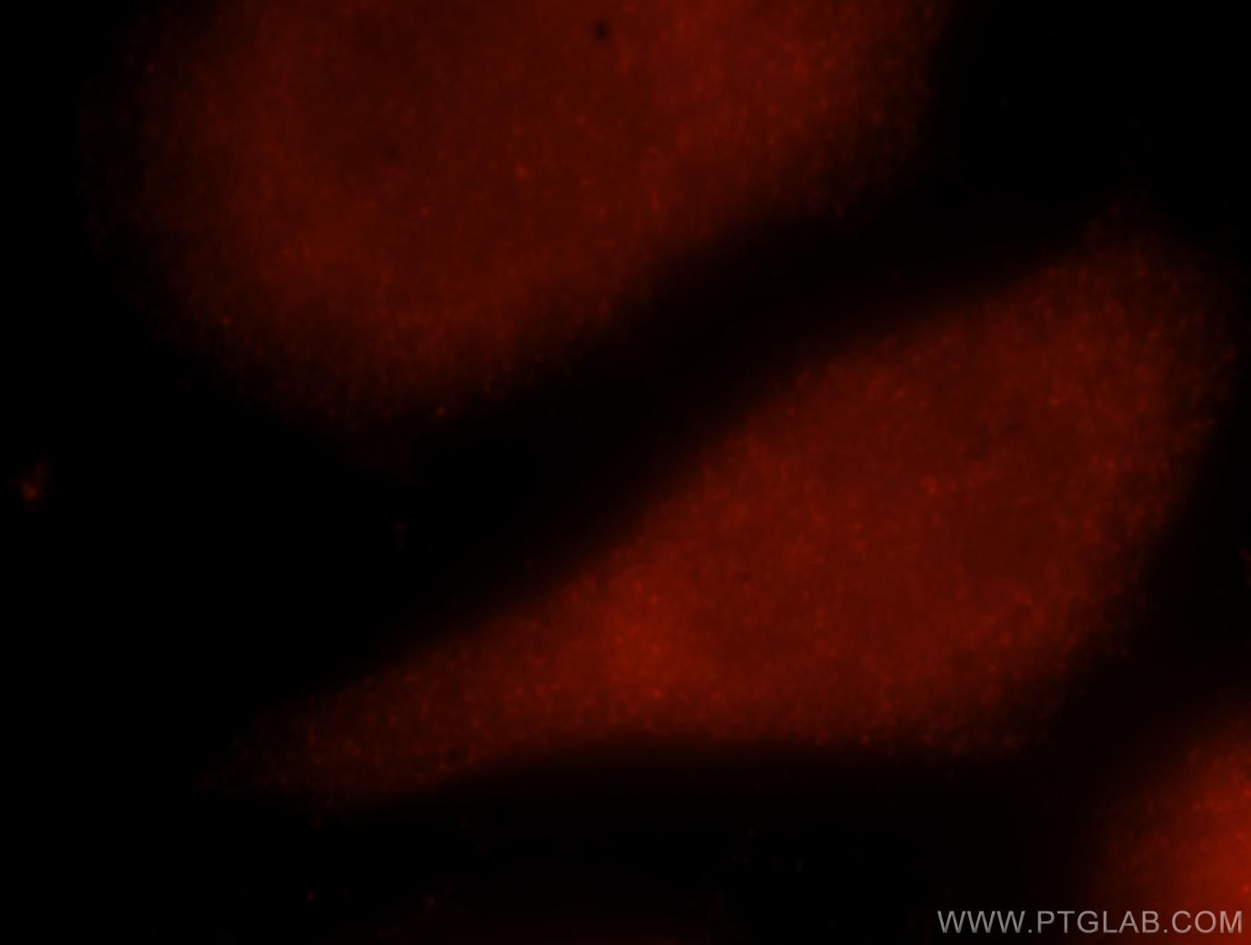 Immunofluorescence (IF) / fluorescent staining of MCF-7 cells using SMAD5 Polyclonal antibody (12167-1-AP)