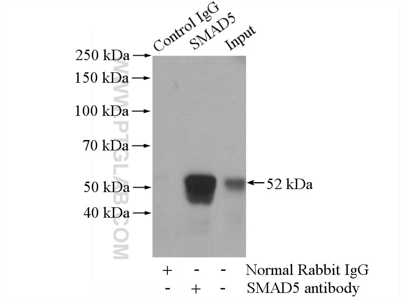 Immunoprecipitation (IP) experiment of K-562 cells using SMAD5 Polyclonal antibody (12167-1-AP)
