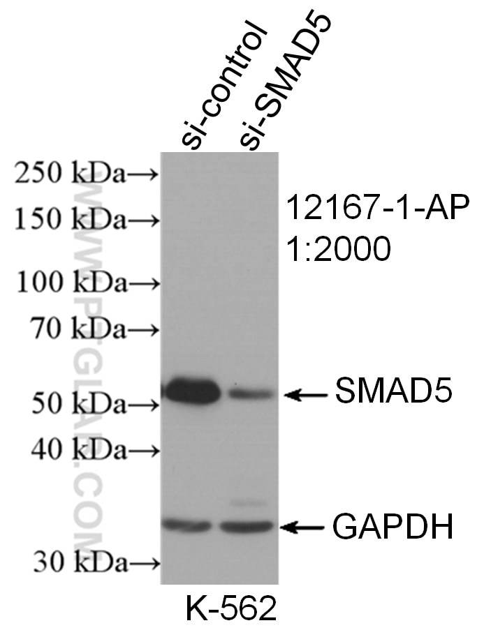 Western Blot (WB) analysis of K-562 cells using SMAD5 Polyclonal antibody (12167-1-AP)