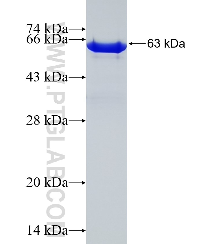 SMAD5 fusion protein Ag2809 SDS-PAGE