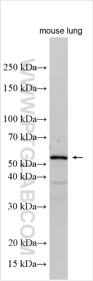 Western Blot (WB) analysis of various lysates using SMAD6 Polyclonal antibody (18342-1-AP)