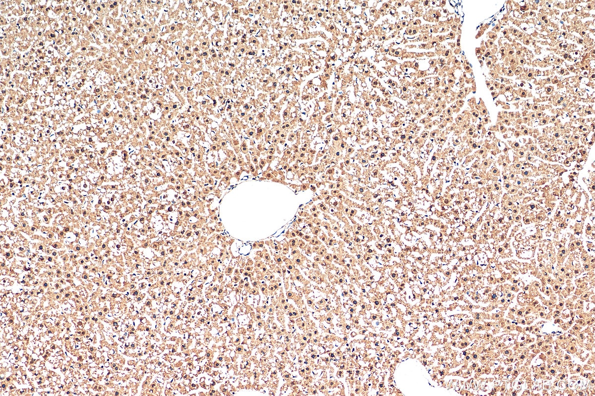 Immunohistochemistry (IHC) staining of mouse liver tissue using SMAD7 Polyclonal antibody (25840-1-AP)