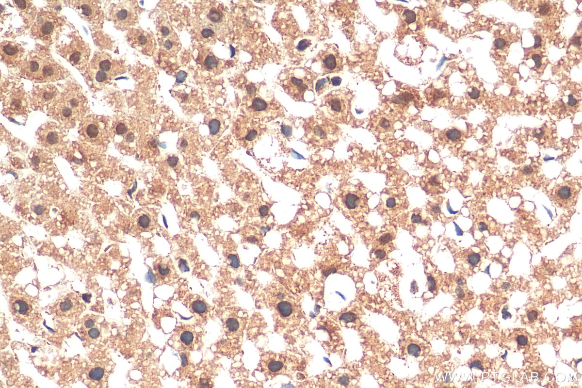 IHC staining of mouse liver using 25840-1-AP