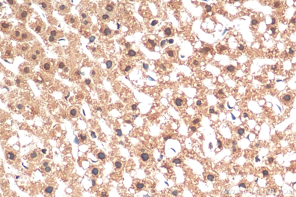 Immunohistochemistry (IHC) staining of mouse liver tissue using SMAD7 Polyclonal antibody (25840-1-AP)