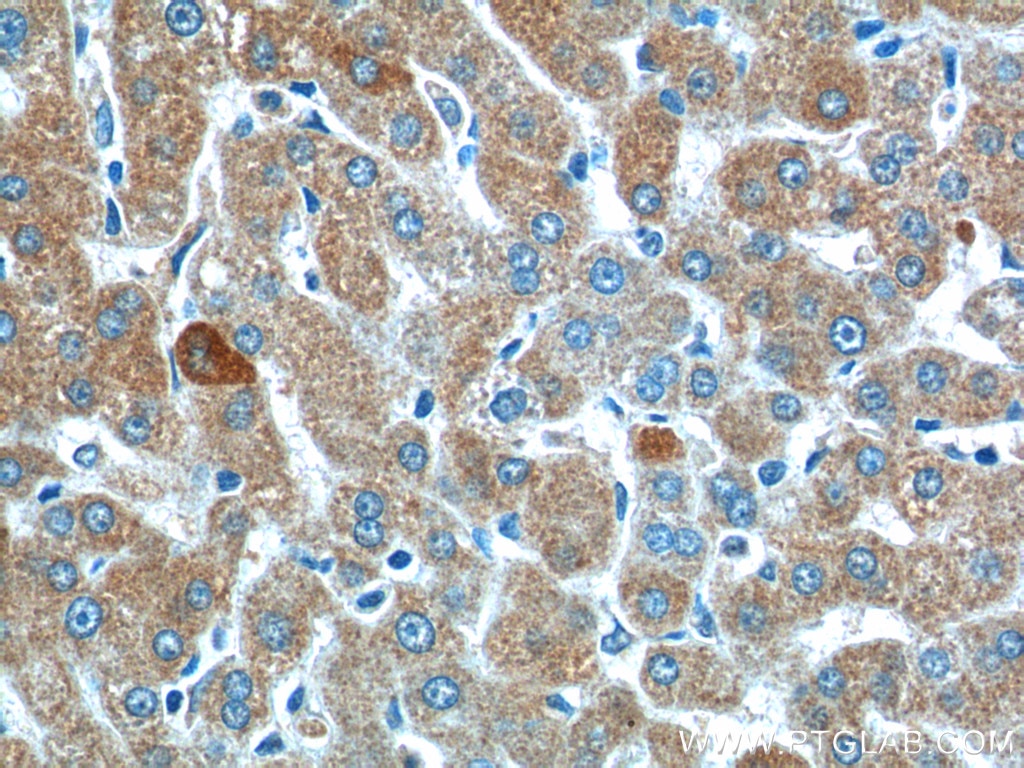 SMAD7 Polyclonal antibody