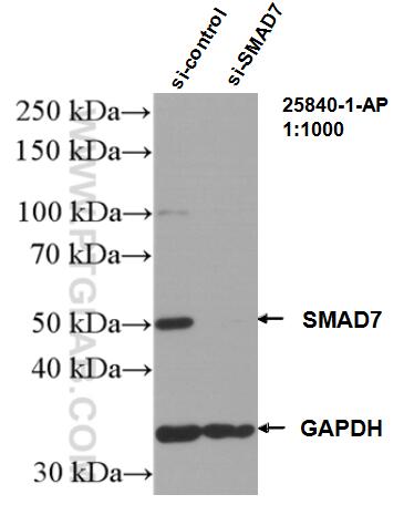 Western Blot (WB) analysis of HepG2 cells using SMAD7 Polyclonal antibody (25840-1-AP)