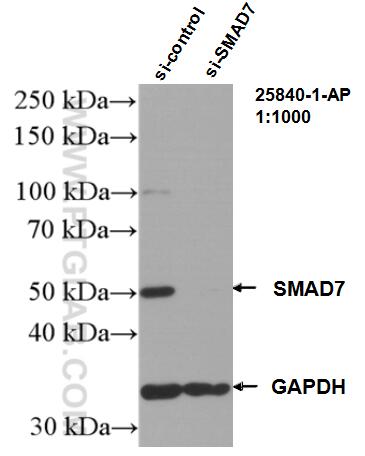 WB analysis of HepG2 using 25840-1-AP