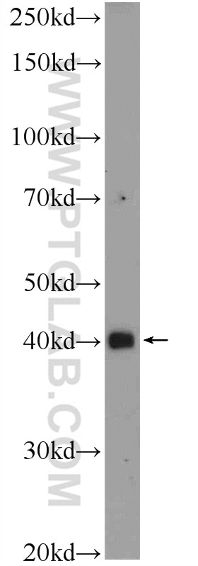 SMAD7 Polyclonal antibody