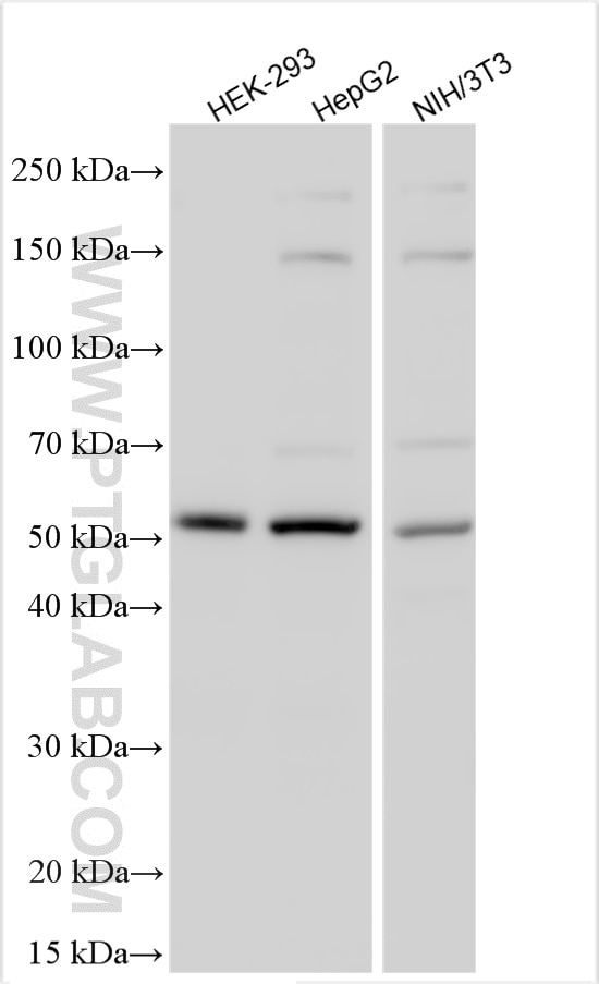 Western Blot (WB) analysis of various lysates using SMAD7 Polyclonal antibody (25840-1-AP)