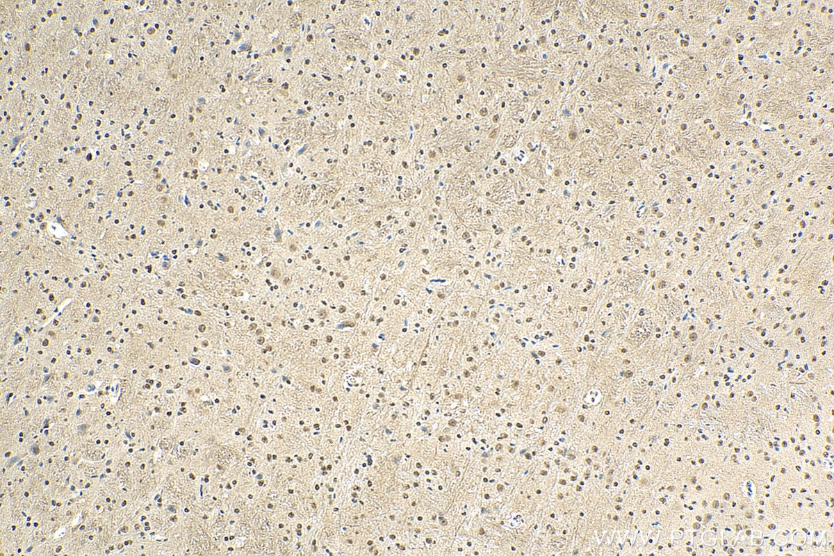 Immunohistochemistry (IHC) staining of mouse cerebellum tissue using SMAD7 Monoclonal antibody (66478-1-Ig)