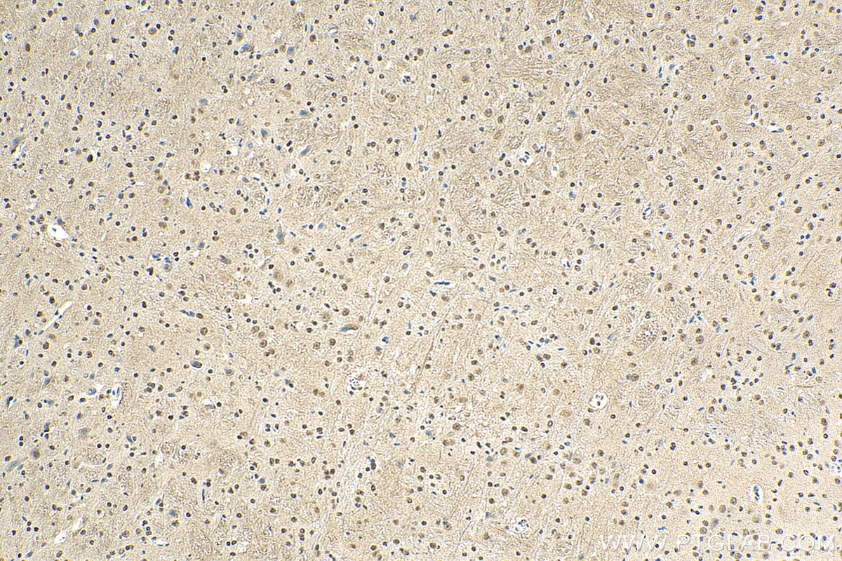 Immunohistochemistry (IHC) staining of mouse cerebellum tissue using SMAD7 Monoclonal antibody (66478-1-Ig)