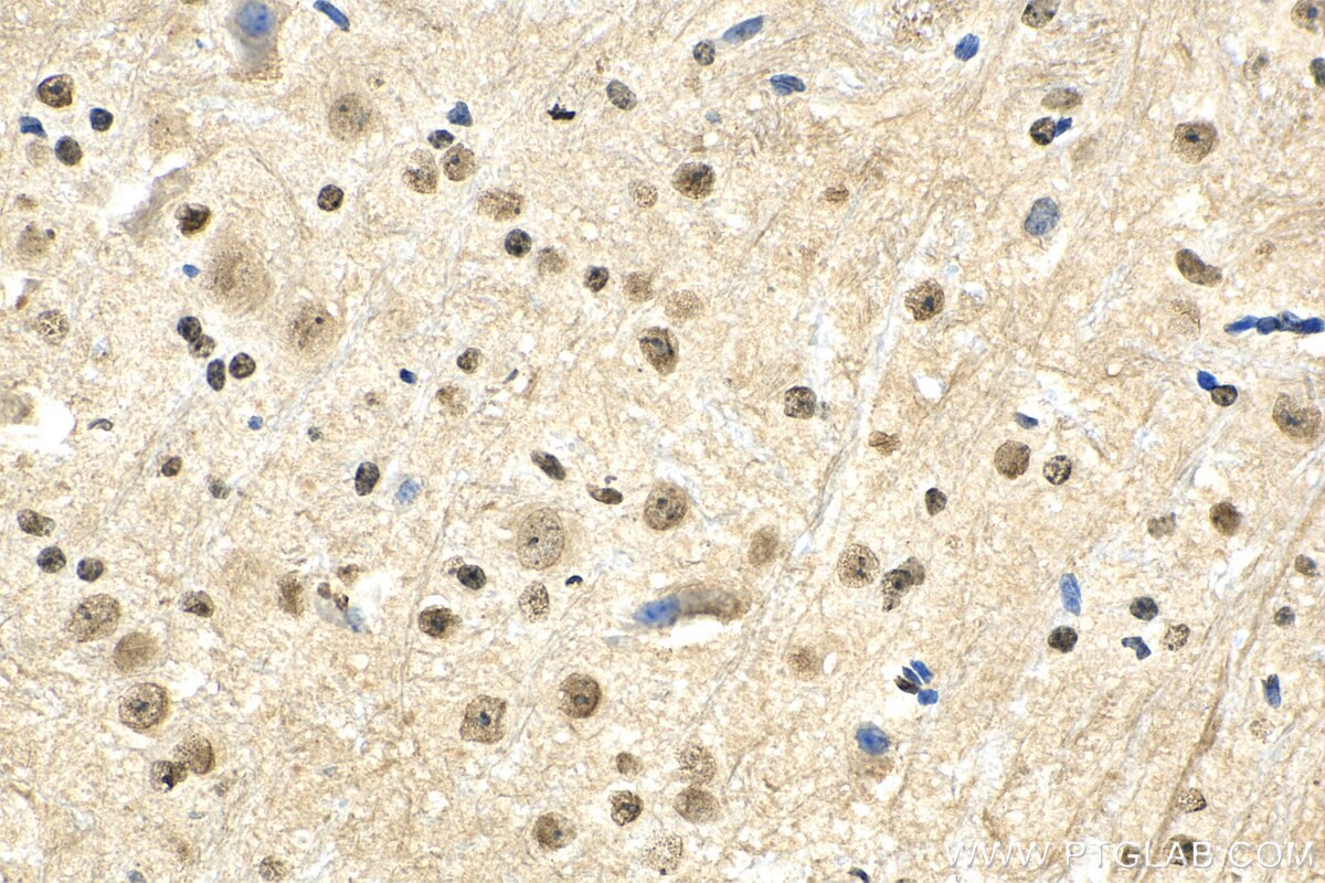 Immunohistochemistry (IHC) staining of mouse cerebellum tissue using SMAD7 Monoclonal antibody (66478-1-Ig)