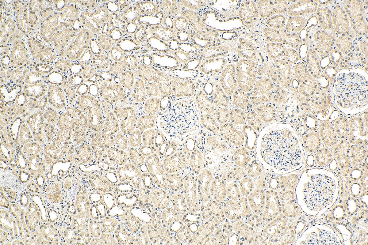 Immunohistochemistry (IHC) staining of human kidney tissue using SMAD7 Monoclonal antibody (66478-1-Ig)