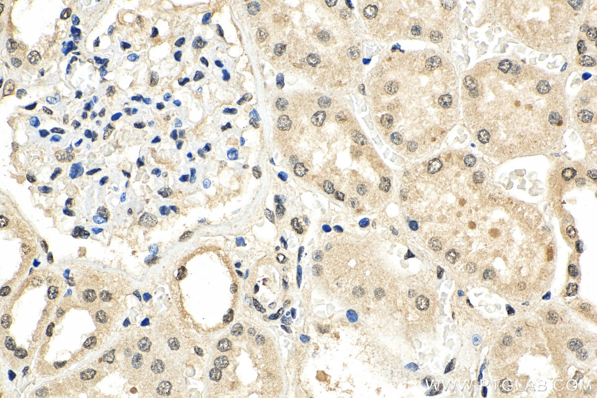 Immunohistochemistry (IHC) staining of human kidney tissue using SMAD7 Monoclonal antibody (66478-1-Ig)