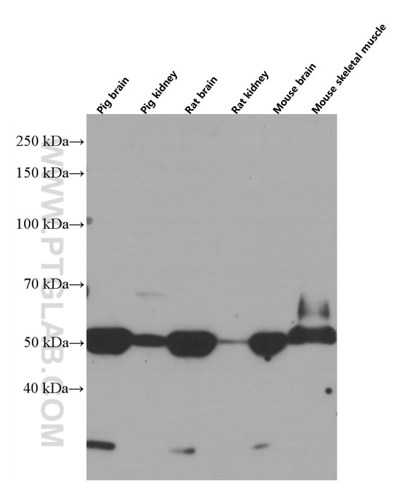 Western Blot (WB) analysis of various lysates using SMAD7 Monoclonal antibody (66478-1-Ig)