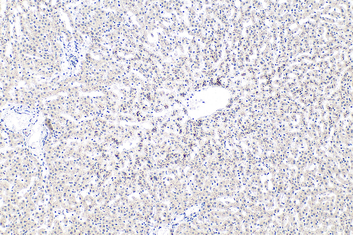Immunohistochemistry (IHC) staining of human liver tissue using SMAD7 Monoclonal antibody (68594-1-Ig)