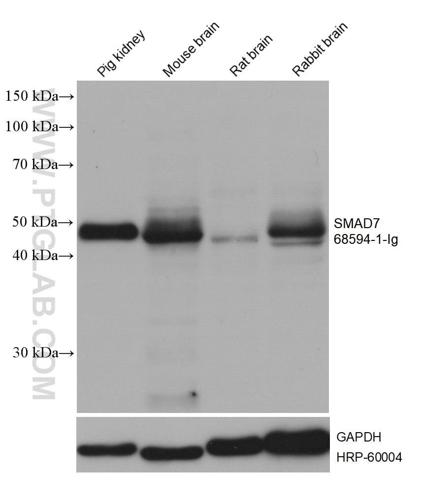Western Blot (WB) analysis of various lysates using SMAD7 Monoclonal antibody (68594-1-Ig)