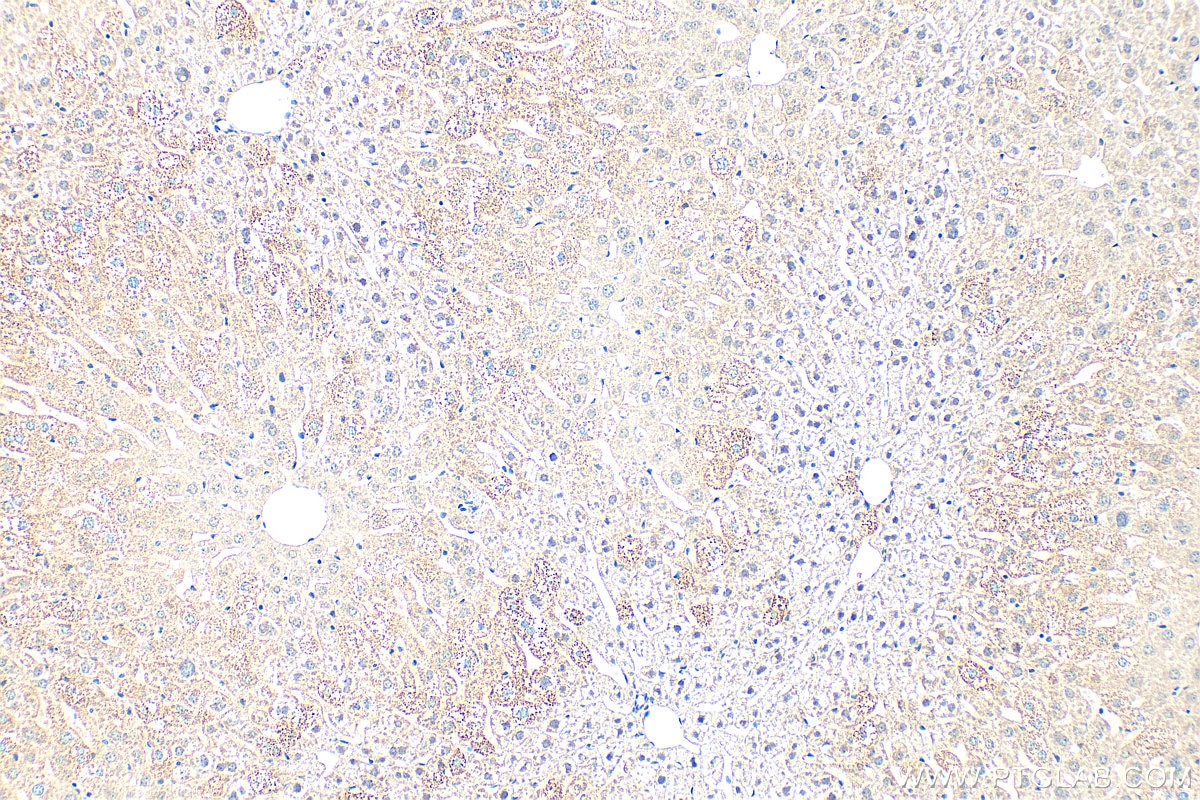 IHC staining of mouse liver using 80964-5-RR Immunohistochemistry (IHC) staining of mouse liver tissue using SMAD7 Recombinant monoclonal antibody (80964-5-RR)