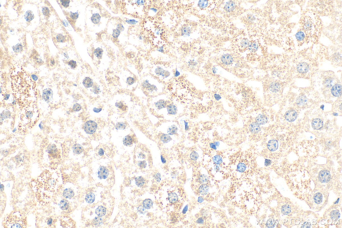 IHC staining of mouse liver using 80964-5-RR Immunohistochemistry (IHC) staining of mouse liver tissue using SMAD7 Recombinant monoclonal antibody (80964-5-RR)