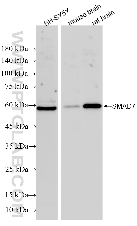 WB analysis using 80964-5-RR Western Blot (WB) analysis of various lysates using SMAD7 Recombinant monoclonal antibody (80964-5-RR)