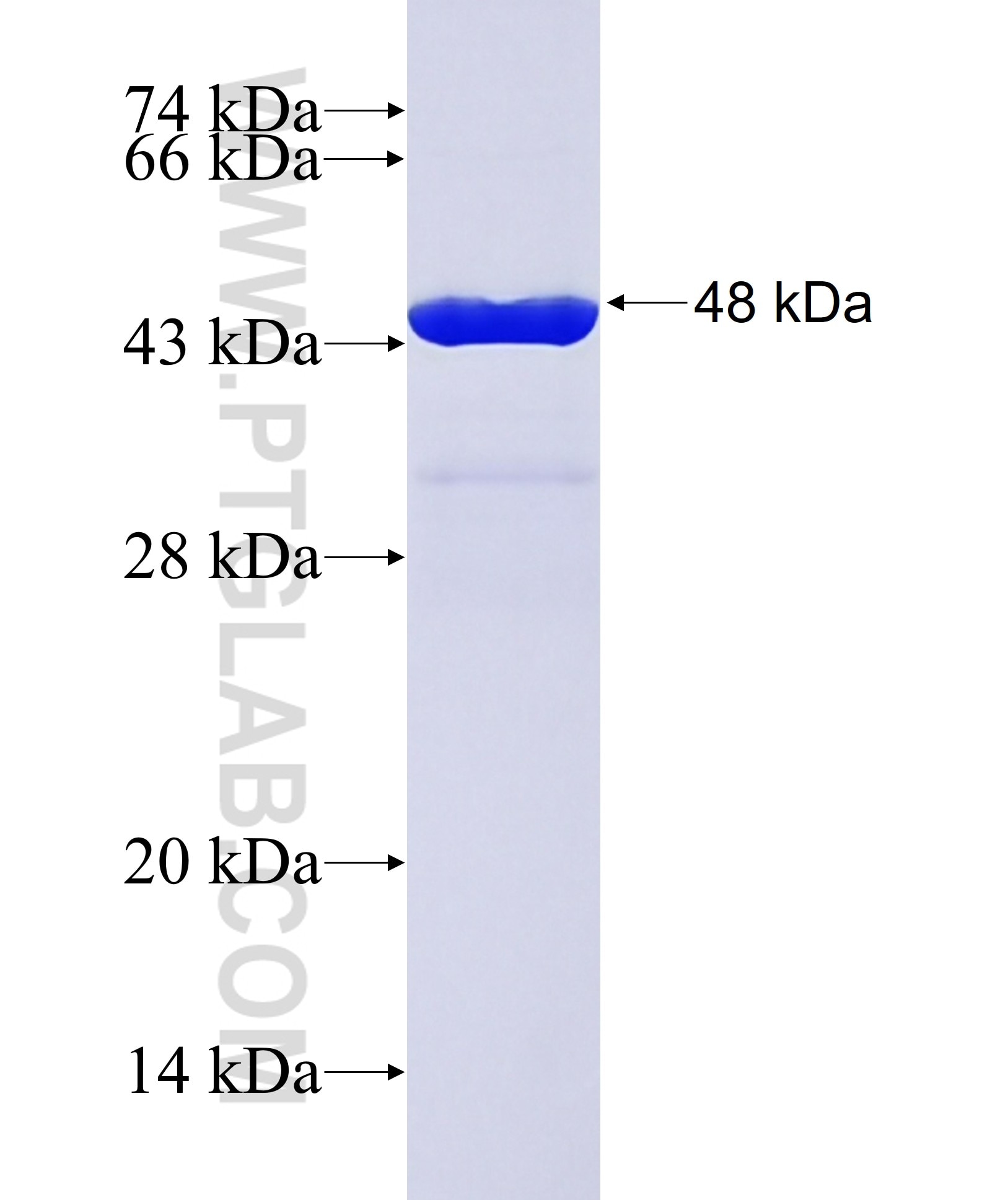 SMAD7 fusion protein Ag32315 SDS-PAGE SMAD7 fusion protein Ag32315 SDS-PAGE