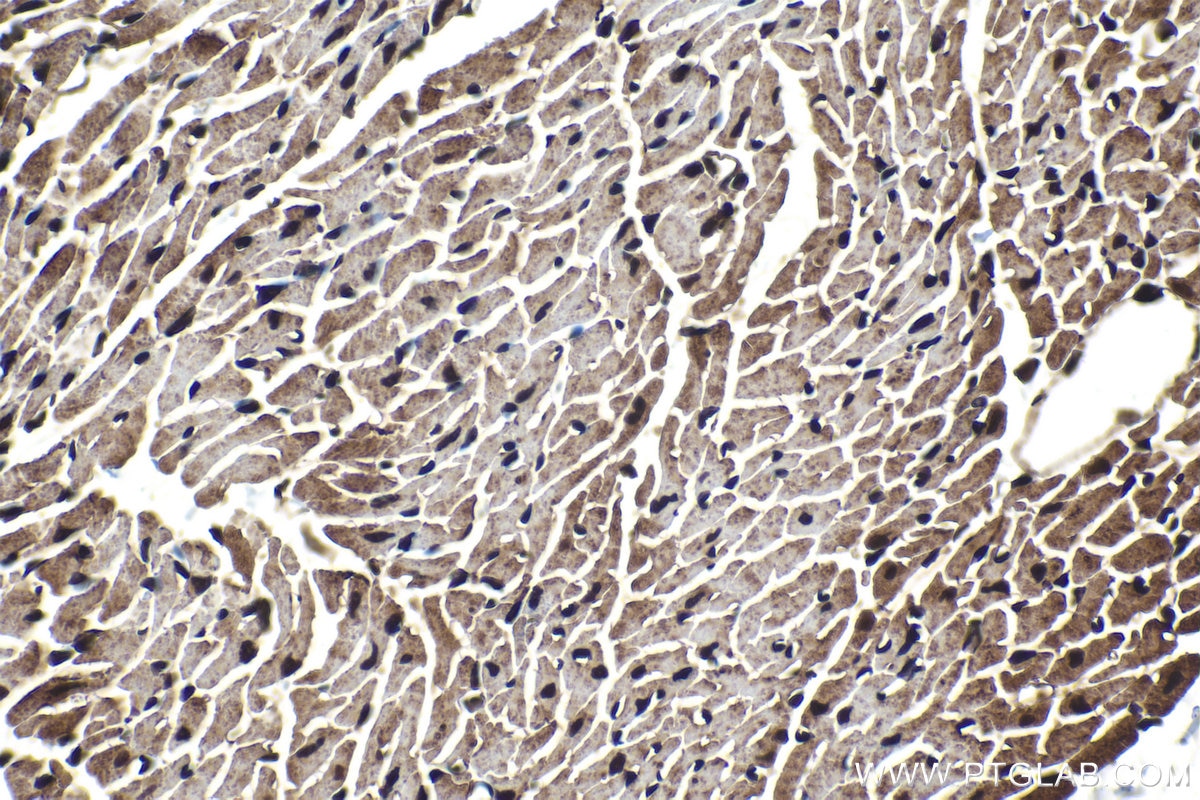 Immunohistochemistry (IHC) staining of mouse heart tissue using SMAD9 Polyclonal antibody (16397-1-AP)