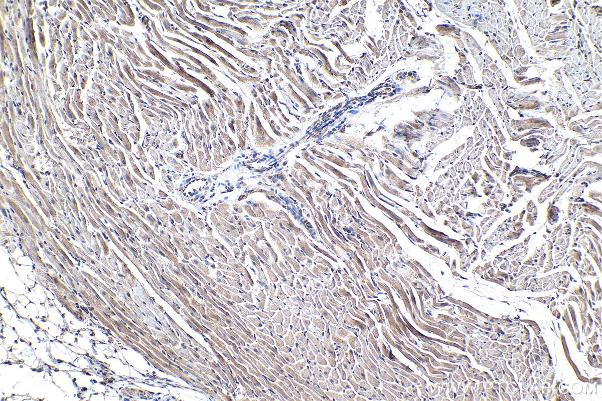 Immunohistochemistry (IHC) staining of rat heart tissue using SMAD9 Polyclonal antibody (16397-1-AP)