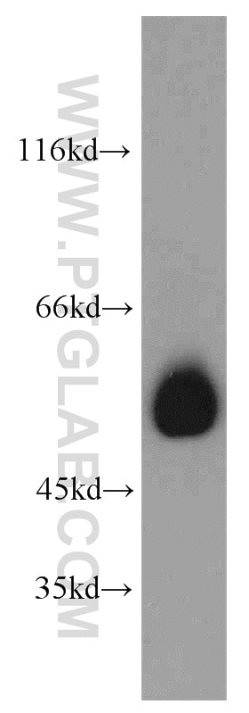 Western Blot (WB) analysis of HEK-293 cells using SMAD9 Polyclonal antibody (16397-1-AP)