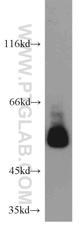 Western Blot (WB) analysis of HepG2 cells using SMAD9 Polyclonal antibody (16397-1-AP)