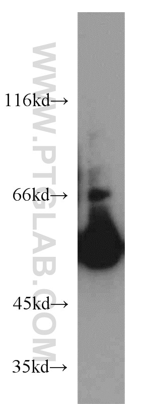 Western Blot (WB) analysis of HeLa cells using SMAD9 Polyclonal antibody (16397-1-AP)