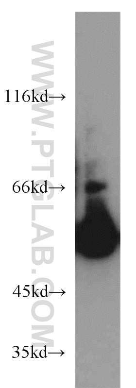 WB analysis of HeLa using 16397-1-AP