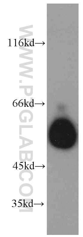Western Blot (WB) analysis of A549 cells using SMAD9 Polyclonal antibody (16397-1-AP)