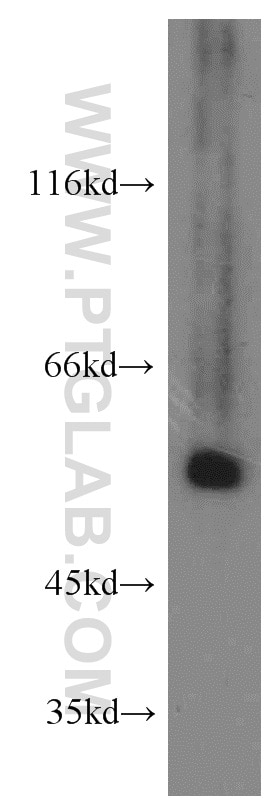 Western Blot (WB) analysis of mouse lung tissue using SMAD9 Polyclonal antibody (16397-1-AP)