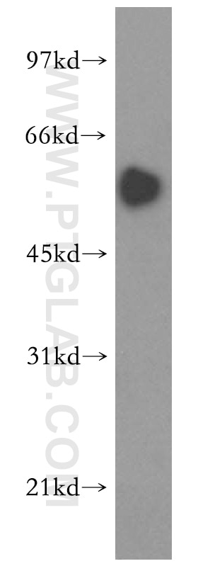 WB analysis of HeLa using 16397-1-AP