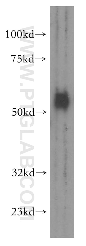 Western Blot (WB) analysis of mouse lung tissue using SMAD9 Polyclonal antibody (16397-1-AP)