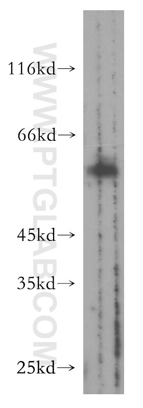 Western Blot (WB) analysis of A549 cells using SMAD9 Polyclonal antibody (16397-1-AP)