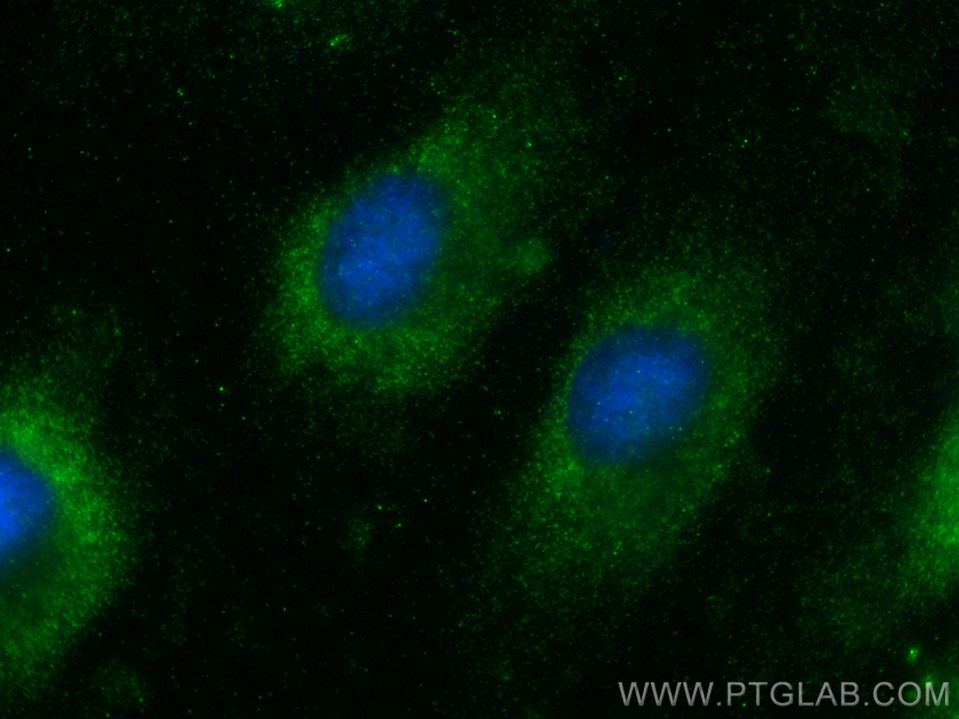 Immunofluorescence (IF) / fluorescent staining of HeLa cells using SMAGP Polyclonal antibody (30910-1-AP)