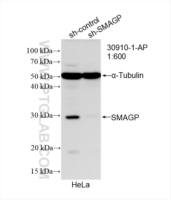 SMAGP