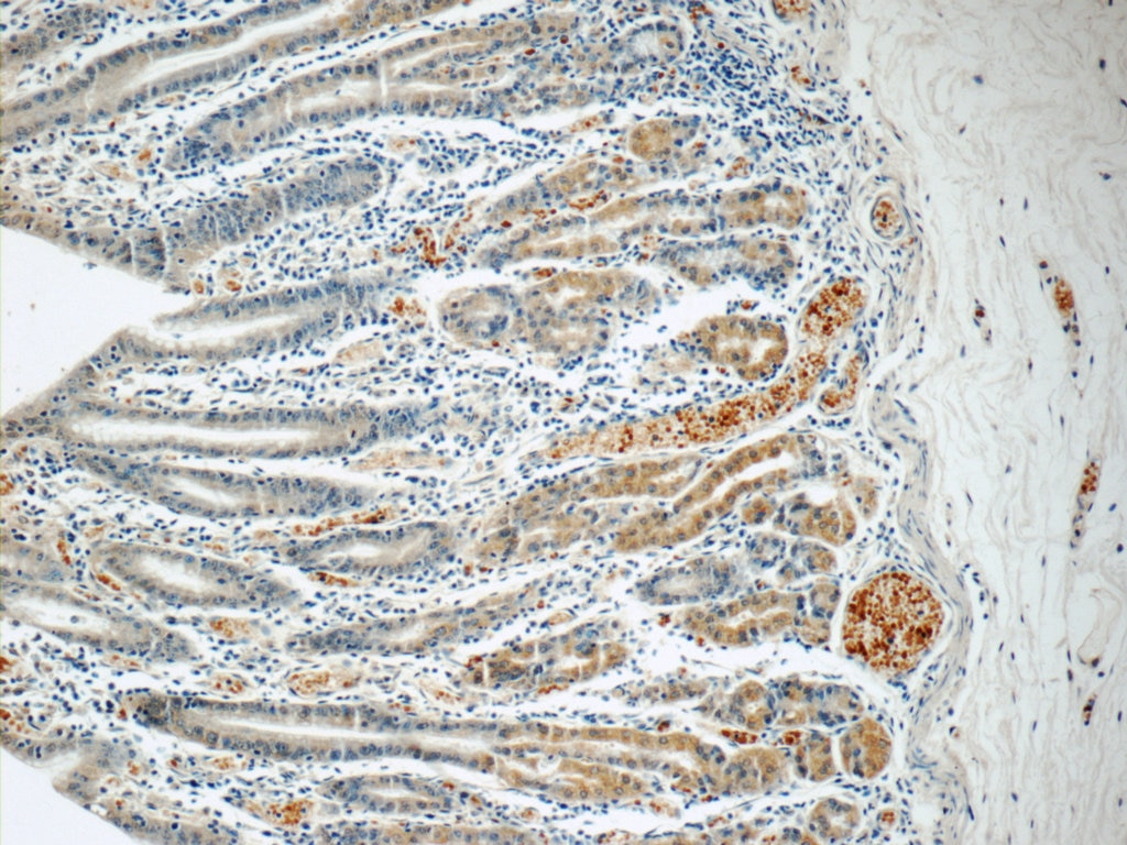 Immunohistochemistry (IHC) staining of human stomach tissue using SMAP1 Polyclonal antibody (12799-1-AP)