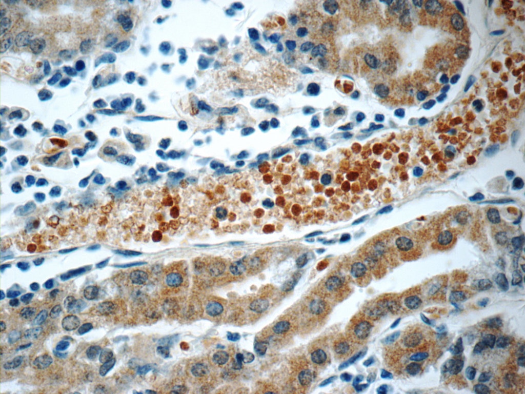 Immunohistochemistry (IHC) staining of human stomach tissue using SMAP1 Polyclonal antibody (12799-1-AP)