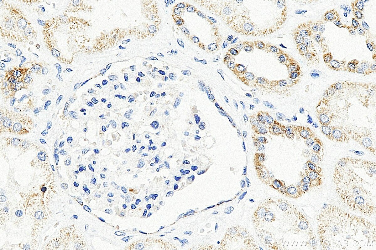 IHC staining of human kidney using 12799-1-AP Immunohistochemistry (IHC) staining of human kidney tissue using SMAP1 Polyclonal antibody (12799-1-AP)