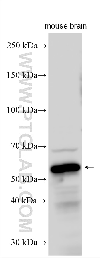 Western Blot (WB) analysis of various lysates using SMAP1 Polyclonal antibody (12799-1-AP)