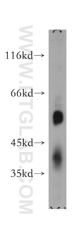 Western Blot (WB) analysis of mouse brain tissue using SMAP1 Polyclonal antibody (12799-1-AP)