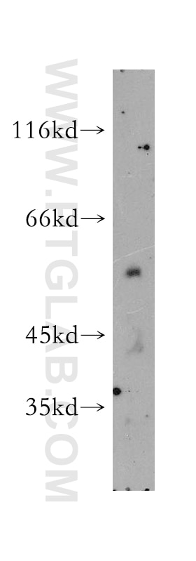Western Blot (WB) analysis of NIH/3T3 cells using SMAP1 Polyclonal antibody (12799-1-AP)