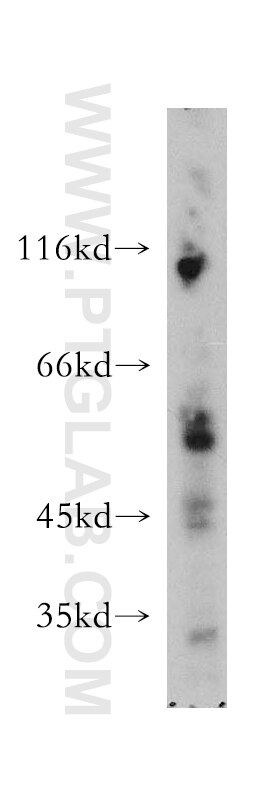Western Blot (WB) analysis of human adrenal gland tissue using SMAP1 Polyclonal antibody (12799-1-AP)