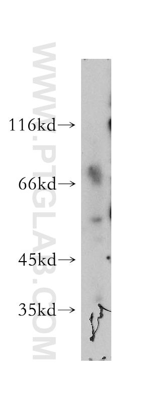Western Blot (WB) analysis of human plasma using SMAP1 Polyclonal antibody (12799-1-AP)